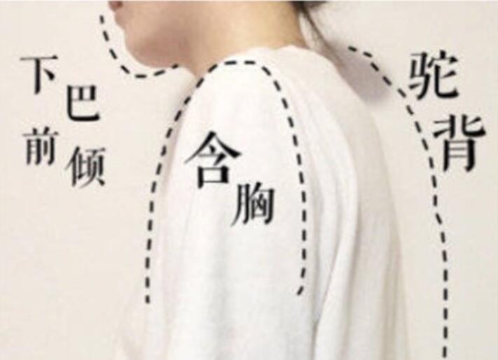 南寧美容學(xué)校：堅持一個月，駝背變直背