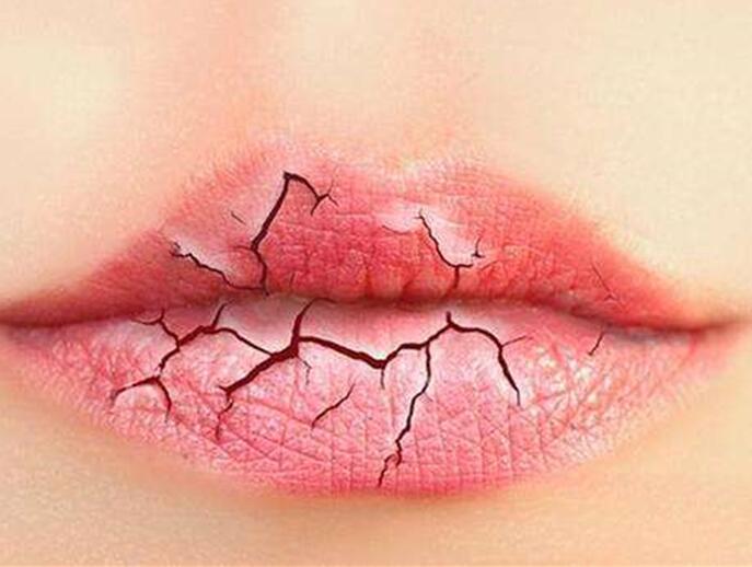 6個美容技巧，解決秋季嘴唇干燥