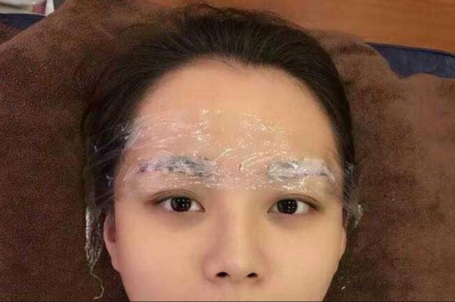 紋繡技巧：怎樣才能發(fā)揮麻藥效果