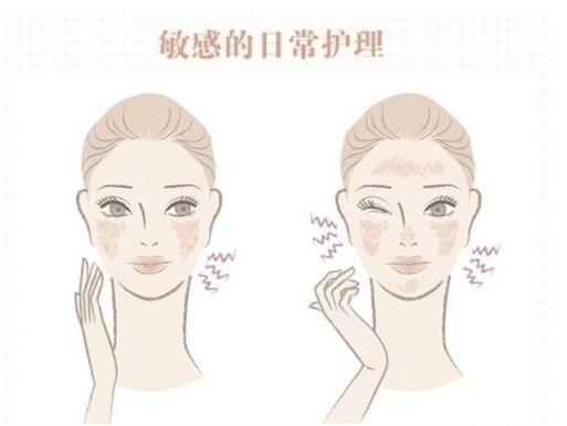 敏感肌保養(yǎng)大全！