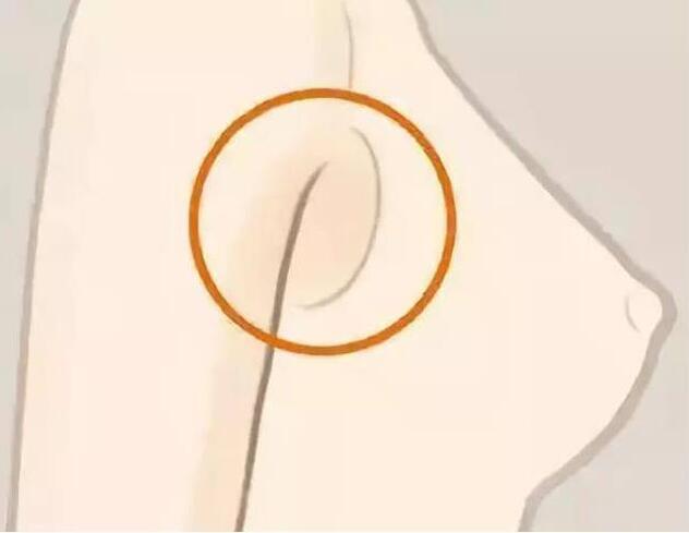 減副乳，瘦手臂一招就解決！