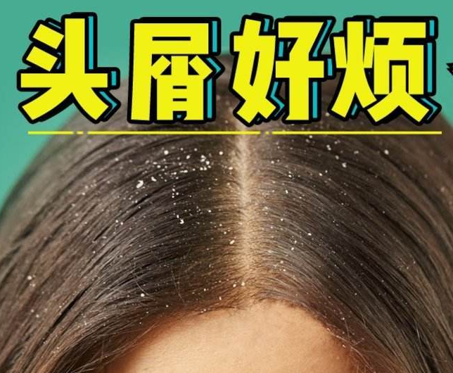 南寧正規(guī)美發(fā)培訓(xùn)學(xué)校分享：冬天如何減少頭屑過多？