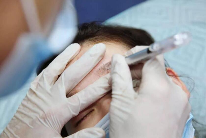 紋繡遇到容易出血的皮膚怎么辦？南寧專業(yè)紋繡培訓教你