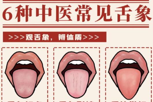 6種常見中醫(yī)舌診判定，快和廣西中醫(yī)美容一起學