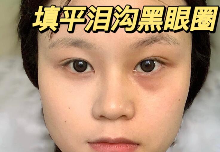 填平淚溝黑眼圈教程，廣西南寧化妝學(xué)校分享