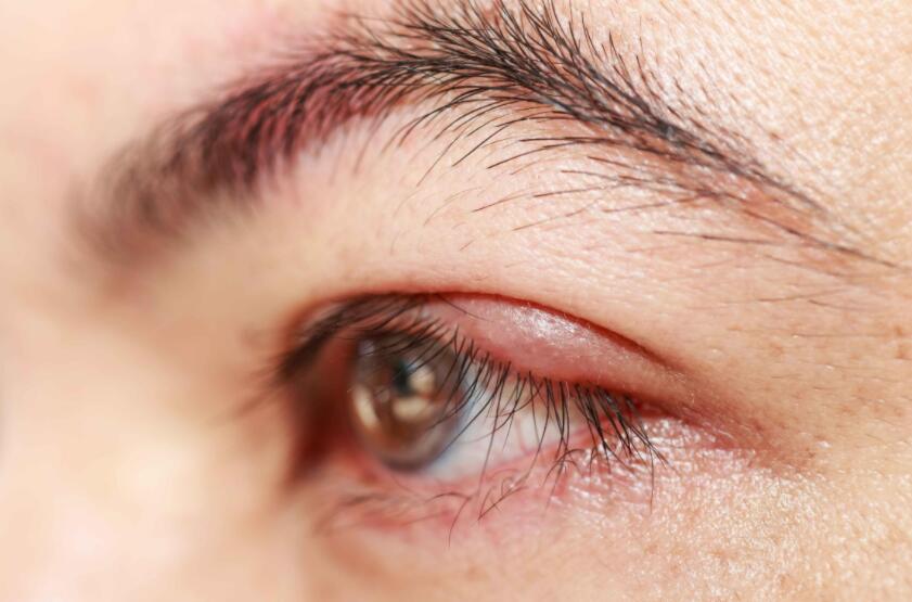 學紋繡理論知識：認識“壞眉”分類