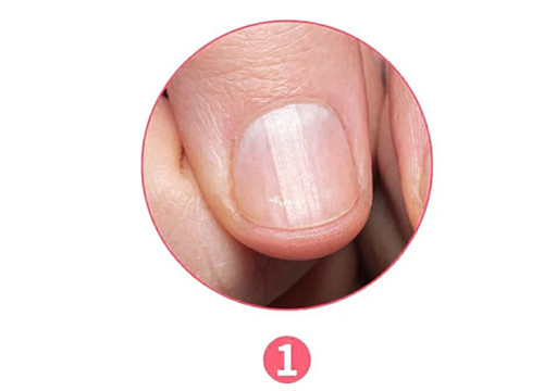 女生氣血不足六大表現(xiàn)，南寧美容養(yǎng)生資訊報(bào)道