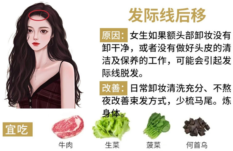 如何改善掉頭發(fā)？南寧頭療養(yǎng)發(fā)護發(fā)教學