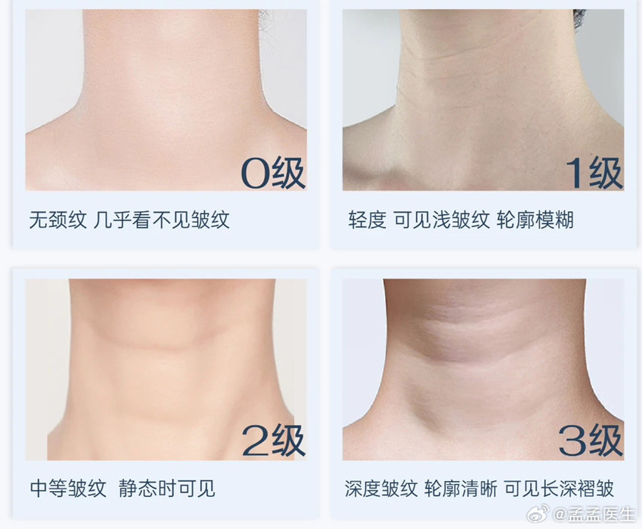 如何緩解頸紋？南寧美體美容管理培訓