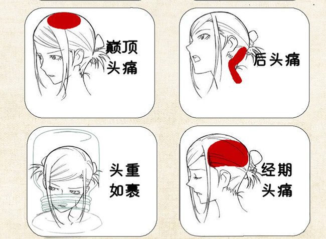 不同頭痛類(lèi)型經(jīng)絡(luò)護(hù)理方法，廣西中醫(yī)美容培訓(xùn)