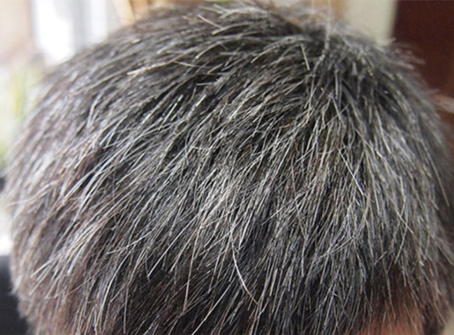 南寧美發(fā)基礎(chǔ)教學(xué)：為什么會(huì)長(zhǎng)白頭發(fā)？